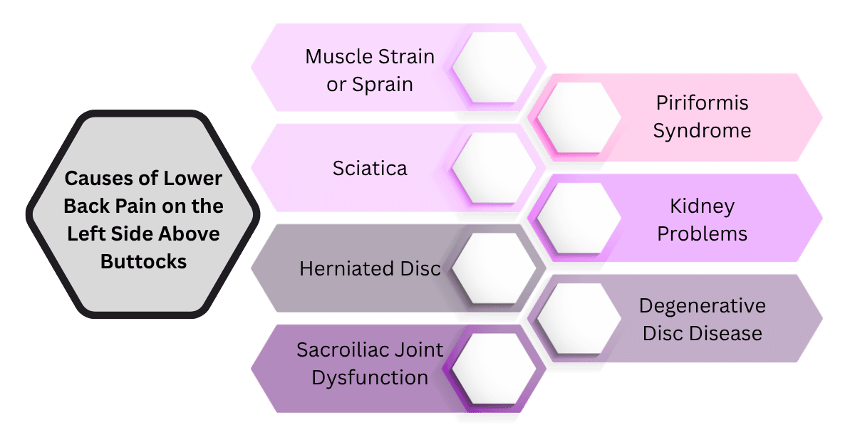 Causes of Lower Back Pain