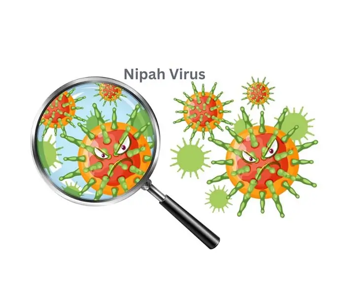 nipah virus