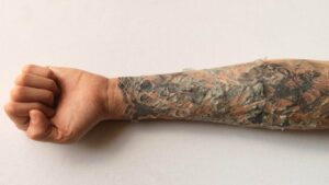 skin allergies by tattoos