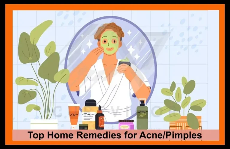 Top Home Remedies for Acn