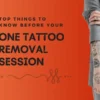 Top Things to know before your Tattoo Removal