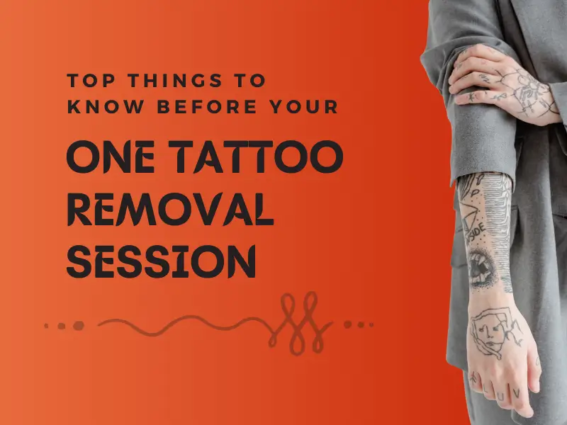 Top Things to know before your Tattoo Removal