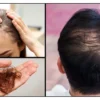 hair loss