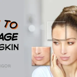 Manage Oily Skin