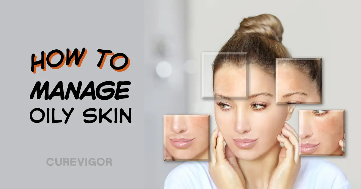 Manage Oily Skin CureVigor