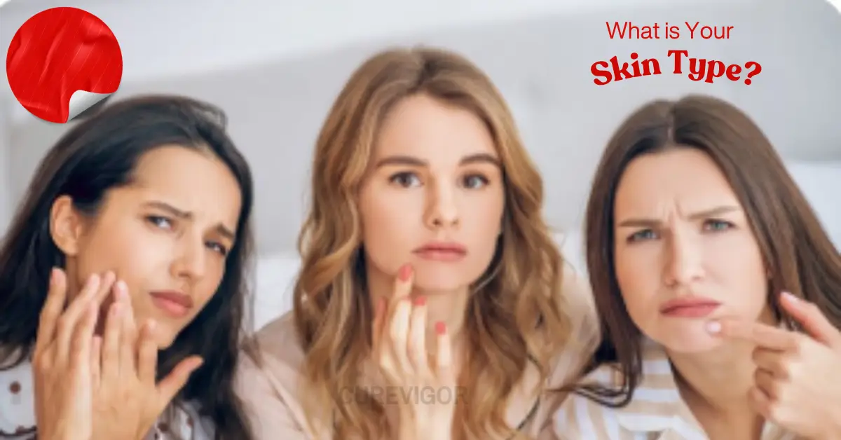 Skin Type CureVigor