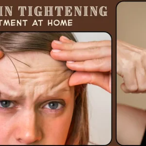 best skin tightening treatment