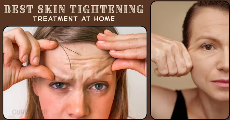 best skin tightening treatment