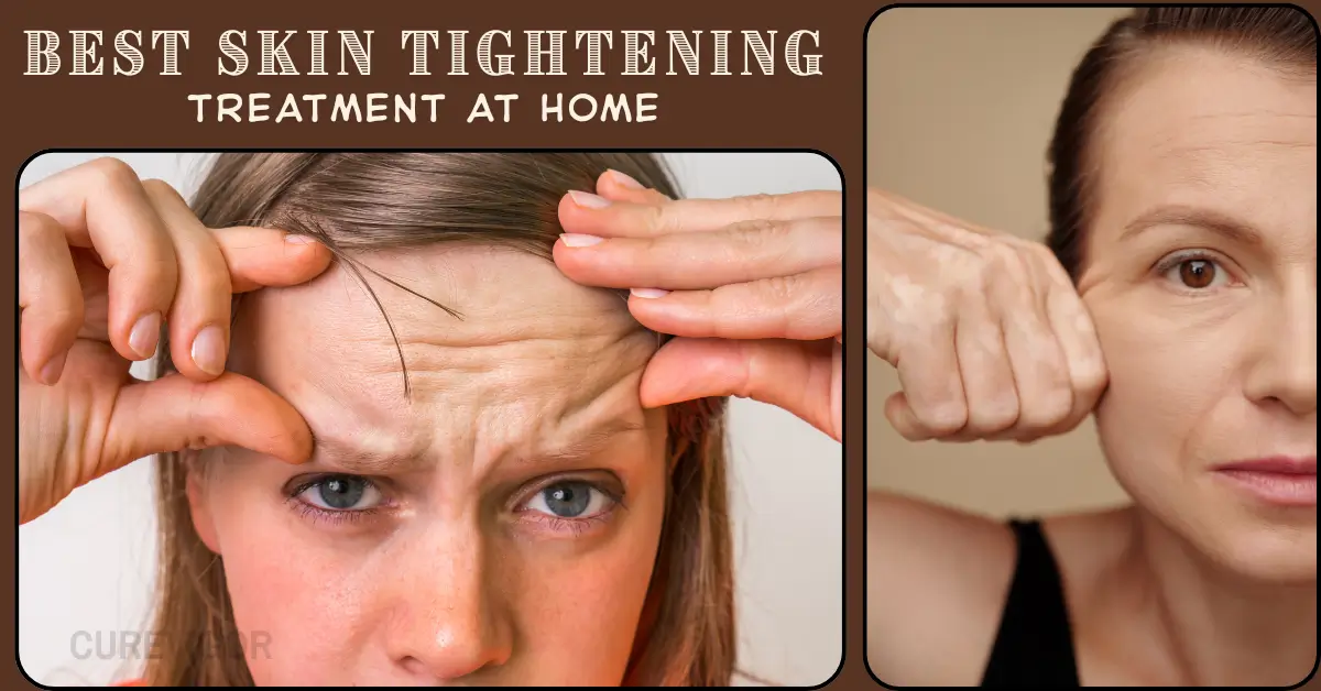 best skin tightening treatment